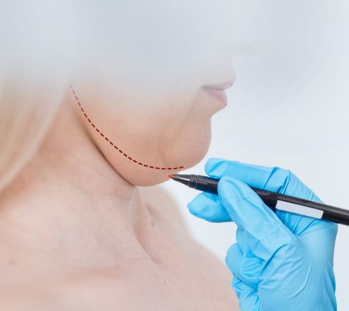 Curso de Lipo de Papada Online Promoção