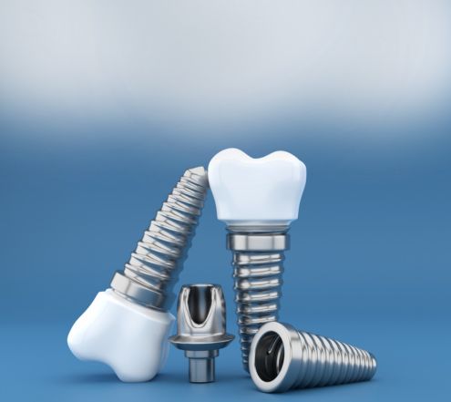 Curso de Prótese sobre Implante Online Promoção